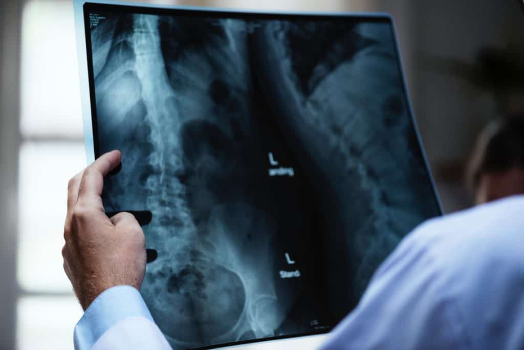 xray